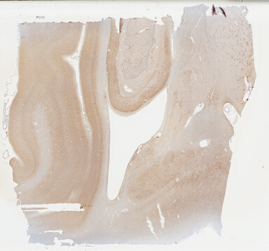 ['deident_cfec02f7-1431-44d6-a244-0a610cd87dd5_69b03e20.jpg']