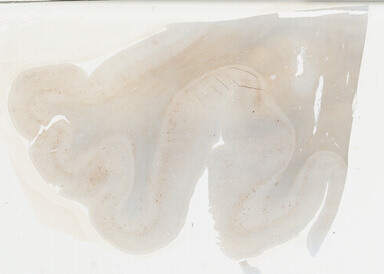 ['deident_9874d179-db48-4a30-8b06-85f967000ce6_69b03e10.jpg']