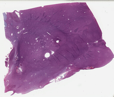 ['deident_9c6a833d-af78-4bd6-9530-74e8d371561d_69b03e12.jpg']