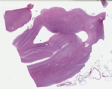 ['deident_db0ff4bd-9a80-462a-9fab-f13b17ac22fe_69b03e27.jpg']