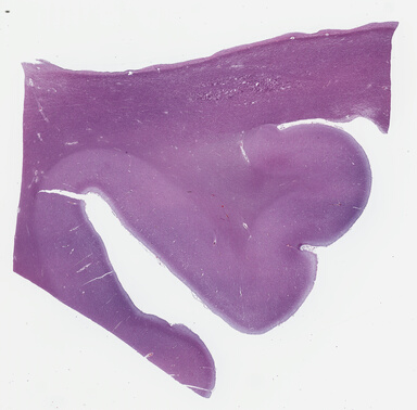 ['deident_2ddb94be-ded1-4f19-baca-f413998aaf75_69b03dee.jpg']