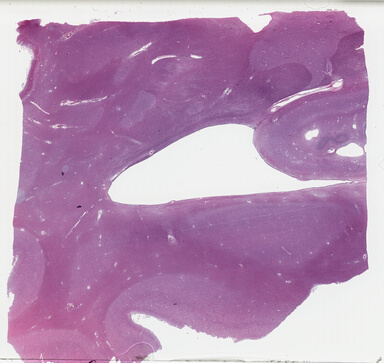 ['deident_ced2e492-b3b6-47f5-8cc3-d4ac2525ed75_69b03e1e.jpg']