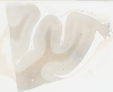 ['deident_4faa5196-e9f5-4dec-a5a9-359b7e62db0e_69b03df7.jpg']