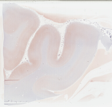 ['deident_c87127c8-d12a-49c9-831d-26407d6f8d06_69b03e1d.jpg']