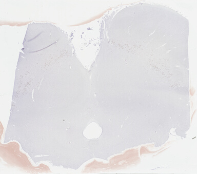 ['deident_f10dff89-aab7-479d-9f0a-6c388b58174a_69b03e30.jpg']