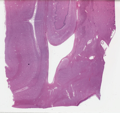 ['deident_d25a4e56-a249-46ef-9f9a-1f387b7f4099_69b03e22.jpg']