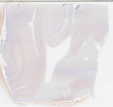 ['deident_90430595-4d23-4e59-b970-4d0b862cadb0_69b03e0b.jpg']