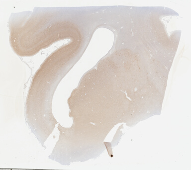 ['deident_34e0314c-052c-46ef-b5ef-54cc79fa6c20_69b03df2.jpg']