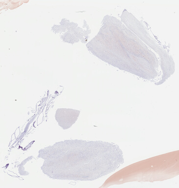 ['deident_d3ac859d-f084-4037-bcc9-c78af89bbba4_69b03e24.jpg']