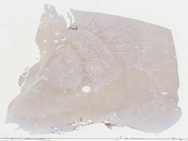 ['deident_4ff5afa4-9154-41fb-8e15-62823b2df63a_69b03df9.jpg']