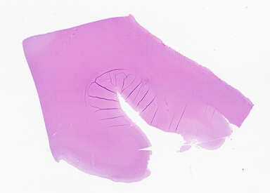 ['deident_754e9a14-d3ea-4ad7-924c-c919a4fbf3e8_69b0563a.jpg']