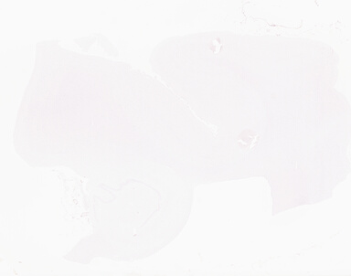 ['deident_5683f4c1-af87-4027-bdbd-8b1a0f73b161_69b0562d.jpg']
