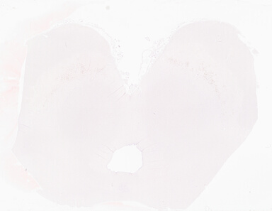 ['deident_0b5f17e5-9dbf-4a8e-8280-2ad58a9689b8_69b05617.jpg']