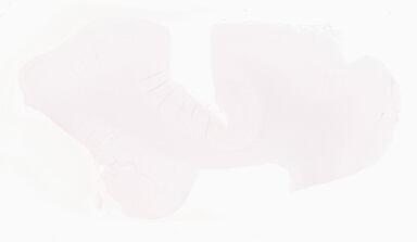 ['deident_d6ac0e87-9fbf-4462-8c46-9f81192bea3f_69b0565b.jpg']