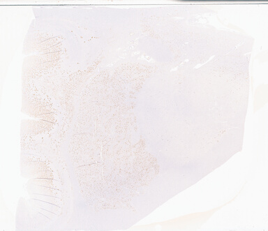 ['deident_948bbeb6-1474-41e8-8c0f-68b23b02ae0c_69b05643.jpg']