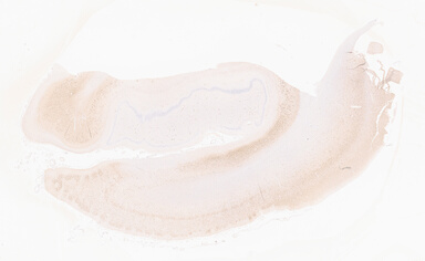 ['deident_c4a73e14-f8c8-4a2a-a195-d52089762d85_69b05656.jpg']