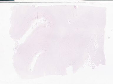 ['deident_6b65b75d-1a97-49a6-9b8f-5f2e8a39ea9b_69b05631.jpg']