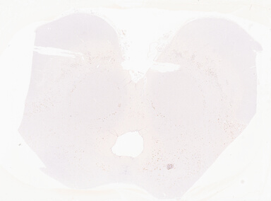 ['deident_1d8e7418-f5c2-4fbb-84ee-d0a4828f0506_69b0561d.jpg']