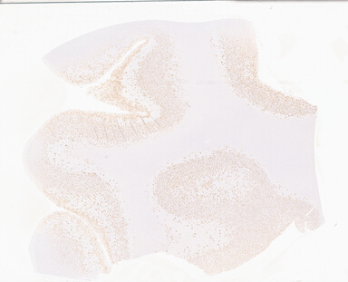 ['deident_1b9a74c5-e99e-4999-9981-e6ab7b11d07c_69b0561c.jpg']