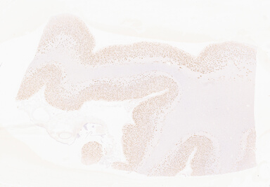 ['deident_b789d537-badc-46c4-8bed-4552f1b14c11_69b05651.jpg']