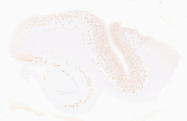 ['deident_a9d33105-1d39-4201-a26e-4dcab0050739_69b05649.jpg']