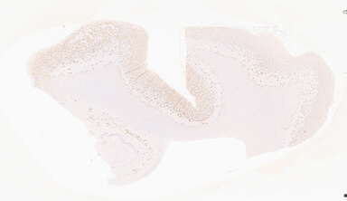 ['deident_f71c4526-c1ba-44f2-a227-7d558fdae29b_69b05660.jpg']