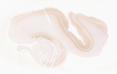 ['deident_df0c7025-9e86-4d14-bd8e-f6f10bb7fc55_69b0565d.jpg']