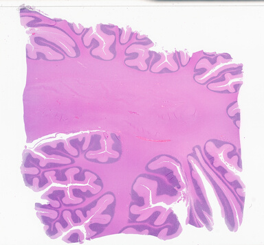 ['deident_fb055473-222d-45dc-9cf7-99a7dc4d4c8b_69b05662.jpg']