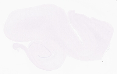 ['deident_7406e25e-7445-48ed-81ee-6d7e93d929ef_69b05636.jpg']