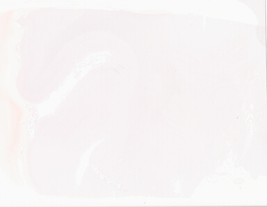 ['deident_6c753c8a-f712-4f3e-9a6b-56cc745b26b8_69b05633.jpg']