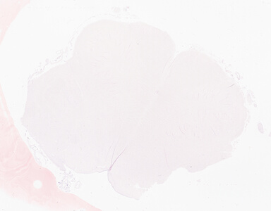 ['deident_536559c3-b396-4cdc-9425-eed9ca871dde_69b05629.jpg']