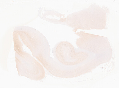 ['deident_d3353358-ca90-4b9d-b413-31a3d198a04b_69b05659.jpg']