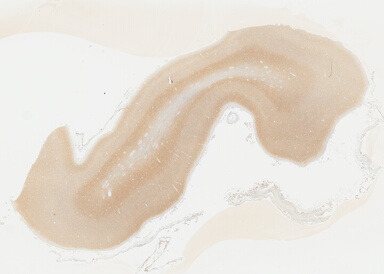 ['deident_f5fdd05a-9bf9-4941-9cbc-5f9767eb77d2_695fcc90.jpg']