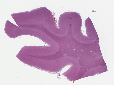 ['deident_dd6bf002-bb4c-485c-ae26-9e4baddc34aa_695fcc82.jpg']