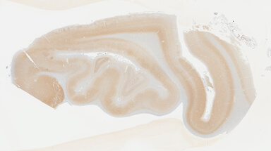 ['deident_cd282f98-484e-483e-ba46-7f3c0bce3934_695fcc7d.jpg']