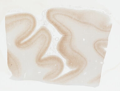 ['deident_19e410d5-7f84-486e-accb-37cf2c2b86f5_695fcc3f.jpg']