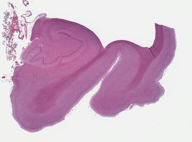 ['deident_85cf8a0e-907a-4d89-a0fe-2d5ac9df3137_695fcc5c.jpg']