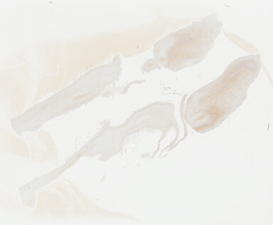 ['deident_57445fcd-ad7f-4d11-8055-29dd7d0d6d54_695fcc4a.jpg']