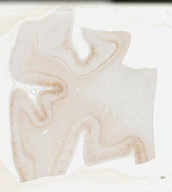 ['deident_0d741dfb-c996-48d7-a568-02d86c6b6ab9_695fcc3d.jpg']