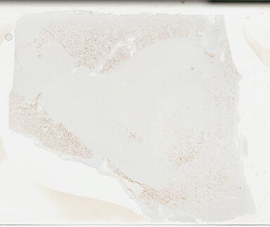 ['deident_c31fafb7-d30c-4c0b-9deb-d9cb9b3c7321_695fcc78.jpg']