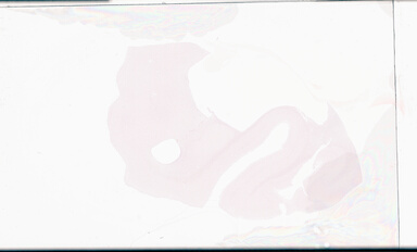 ['deident_5e8cd6af-107b-4204-94fd-191dcb3f5770_695fcc4f.jpg']