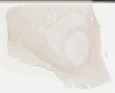 ['deident_734afe53-c3b8-4804-be0e-94f5eb9d6d97_695fcc59.jpg']