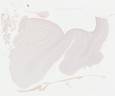 ['deident_a81ce972-f4ab-475d-a3b9-966924d3103b_695fcc6f.jpg']
