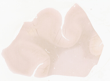 ['deident_b36a3896-f10b-4ea4-951c-058a4e25b9da_69d94217.jpg']