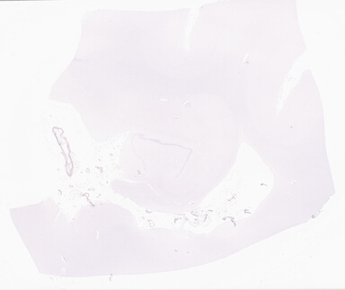 ['deident_6b427a74-7cdb-431a-9b57-80ed05025e49_69d941fc.jpg']