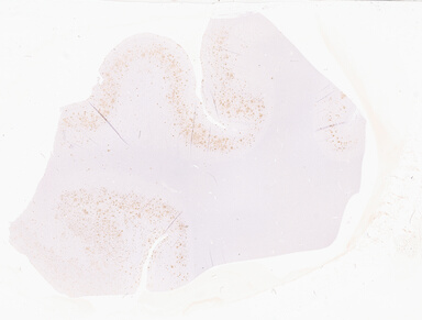['deident_f4930fd2-41b5-47e3-8ebc-6fe8dd91d06e_69d9422d.jpg']