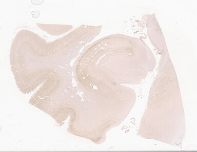['deident_d019837c-a4d8-429c-a966-dcce6e249a25_69d94221.jpg']