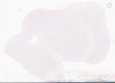 ['deident_e46b4c10-085b-4255-9525-252629c00ab0_69d94223.jpg']