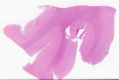 ['deident_ed0d75c9-181b-4358-8cca-35b380955f38_69d94229.jpg']