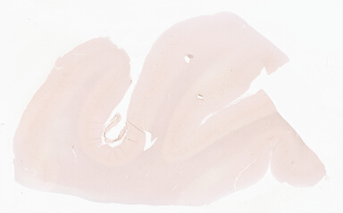['deident_591bc0db-b111-4804-bfbe-5fbfd79d5299_69d941ee.jpg']
